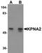 PTAC58 antibody, A01776, Boster Biological Technology, Western Blot image 
