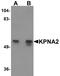 Karyopherin Subunit Alpha 2 antibody, A01776, Boster Biological Technology, Western Blot image 