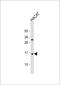 T Cell Leukemia Translocation Altered antibody, MBS9216976, MyBioSource, Western Blot image 