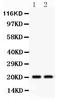 Heat Shock Protein Family B (Small) Member 2 antibody, PB9598, Boster Biological Technology, Western Blot image 