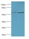 Cytochrome P450 Family 2 Subfamily E Member 1 antibody, MBS7002461, MyBioSource, Western Blot image 