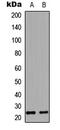 Endothelin 1 antibody, abx121598, Abbexa, Western Blot image 