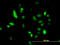 Ubiquitin Conjugating Enzyme E2 C antibody, LS-B12179, Lifespan Biosciences, Immunofluorescence image 