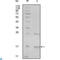 Non-receptor tyrosine-protein kinase TNK1 antibody, LS-C812854, Lifespan Biosciences, Western Blot image 