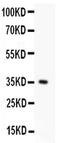 FAS antibody, PA5-79235, Invitrogen Antibodies, Western Blot image 