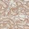 TBC1 Domain Family Member 23 antibody, FNab08513, FineTest, Immunohistochemistry paraffin image 
