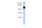 Zinc Finger Protein 681 antibody, 30-751, ProSci, Enzyme Linked Immunosorbent Assay image 