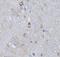 Retinoic acid receptor alpha antibody, FNab07120, FineTest, Immunohistochemistry paraffin image 