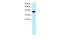 Nuclear Transcription Factor Y Subunit Alpha antibody, 27-329, ProSci, Immunohistochemistry paraffin image 