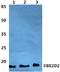 Ubiquitin Conjugating Enzyme E2 D2 antibody, A03971, Boster Biological Technology, Western Blot image 