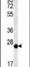 Cysteine Rich Secretory Protein LCCL Domain Containing 2 antibody, PA5-25482, Invitrogen Antibodies, Western Blot image 