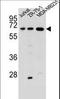 Zinc Finger And SCAN Domain Containing 2 antibody, LS-C160971, Lifespan Biosciences, Western Blot image 
