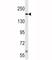 TSC Complex Subunit 2 antibody, F52112-0.4ML, NSJ Bioreagents, Western Blot image 