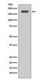 Erb-B2 Receptor Tyrosine Kinase 3 antibody, M00539, Boster Biological Technology, Western Blot image 