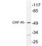 Corticotropin Releasing Hormone Receptor 1 antibody, LS-C177081, Lifespan Biosciences, Western Blot image 