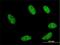 Gastrulation Brain Homeobox 2 antibody, H00002637-M02, Novus Biologicals, Immunocytochemistry image 