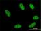 Gastrulation and brain-specific homeobox protein 2 antibody, H00002637-M02, Novus Biologicals, Immunocytochemistry image 