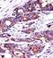 Nucleophosmin 1 antibody, GTX81995, GeneTex, Immunohistochemistry paraffin image 