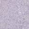 Interleukin 18 Binding Protein antibody, PA5-59412, Invitrogen Antibodies, Immunohistochemistry paraffin image 