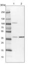 Methylenetetrahydrofolate Dehydrogenase (NADP+ Dependent) 2 Like antibody, PA5-57269, Invitrogen Antibodies, Western Blot image 
