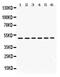 Eukaryotic Translation Initiation Factor 4A2 antibody, PA5-79195, Invitrogen Antibodies, Western Blot image 