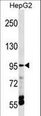 Transient Receptor Potential Cation Channel Subfamily V Member 5 antibody, LS-C160239, Lifespan Biosciences, Western Blot image 