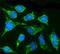 Carnitine Palmitoyltransferase 1B antibody, A03558, Boster Biological Technology, Immunofluorescence image 