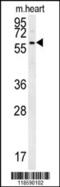 Proline And Arginine Rich End Leucine Rich Repeat Protein antibody, 62-389, ProSci, Western Blot image 