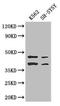 Interferon-inducible protein AIM2 antibody, LS-C498354, Lifespan Biosciences, Western Blot image 