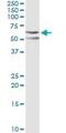 C-Terminal Src Kinase antibody, H00001445-M01, Novus Biologicals, Western Blot image 