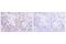 TNF Receptor Superfamily Member 9 antibody, 19541T, Cell Signaling Technology, Immunohistochemistry paraffin image 