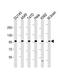 KGFR antibody, GTX25476, GeneTex, Western Blot image 