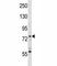 Spleen Associated Tyrosine Kinase antibody, F44546-0.4ML, NSJ Bioreagents, Western Blot image 