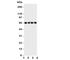 Parathyroid Hormone 1 Receptor antibody, R31247, NSJ Bioreagents, Western Blot image 