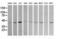Mitogen-Activated Protein Kinase Kinase 1 antibody, LS-C174649, Lifespan Biosciences, Western Blot image 