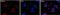 Pyruvate Kinase M1/2 antibody, MA5-14815, Invitrogen Antibodies, Immunofluorescence image 