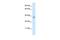 Zinc Finger C2HC-Type Containing 1A antibody, PA5-40590, Invitrogen Antibodies, Western Blot image 