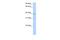 Nudix Hydrolase 17 antibody, A19003, Boster Biological Technology, Western Blot image 