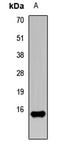 Fatty Acid Binding Protein 5 antibody, LS-C667798, Lifespan Biosciences, Western Blot image 