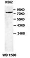 Sp1 Transcription Factor antibody, orb77288, Biorbyt, Western Blot image 