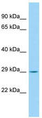 Coiled-coil domain-containing protein 134 antibody, TA331731, Origene, Western Blot image 