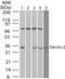 C-Type Lectin Domain Containing 6A antibody, MA5-16250, Invitrogen Antibodies, Western Blot image 