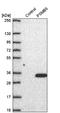 Proteasome Subunit Beta 5 antibody, NBP2-57323, Novus Biologicals, Western Blot image 