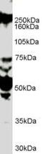 Roundabout Guidance Receptor 1 antibody, PA5-18460, Invitrogen Antibodies, Western Blot image 