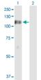Diacylglycerol Kinase Zeta antibody, H00008525-D01P, Novus Biologicals, Western Blot image 