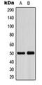 ADP Dependent Glucokinase antibody, MBS8210765, MyBioSource, Western Blot image 