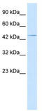 Homeobox A3 antibody, TA341407, Origene, Western Blot image 