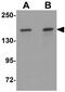 Rho Associated Coiled-Coil Containing Protein Kinase 2 antibody, GTX31837, GeneTex, Western Blot image 