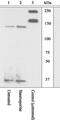 Rho Associated Coiled-Coil Containing Protein Kinase 1 antibody, GTX10549, GeneTex, Western Blot image 
