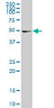 Uridine Monophosphate Synthetase antibody, LS-C139198, Lifespan Biosciences, Western Blot image 